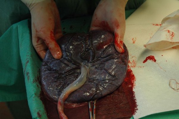 800px-placenta_held.jpg