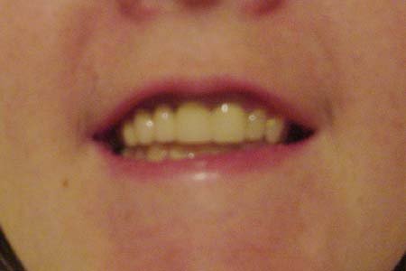 permanent teeth.jpg