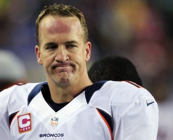 02-mannings-forehead.jpg