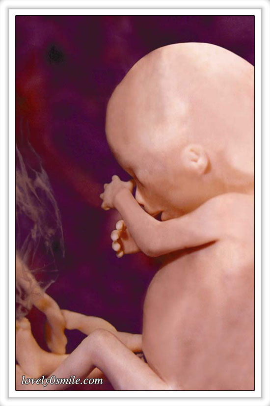fetus-08.jpg